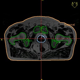 card__image